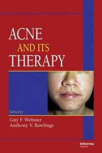 Acne and Its Therapy