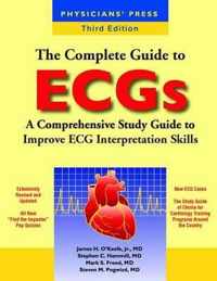 The Complete Guide to ECGs