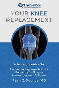 Your Knee Replacement: A Patient&apos;s Guide To: Understanding Knee Arthritis, Preparing for Surgery, Maximizing Your Outcome