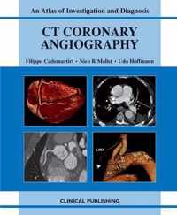 CT Coronary Angiography
