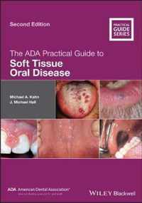 The ADA Practical Guide to Soft Tissue Oral Disease 2e