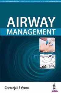 Airway Management