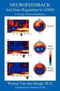 Neurofeedback and State Regulation in ADHD