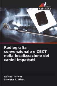 Radiografia convenzionale e CBCT nella localizzazione dei canini impattati