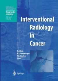 Interventional Radiology in Cancer