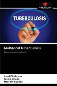 Multifocal tuberculosis