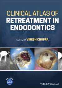 Clinical Atlas of Retreatment in Endodontics