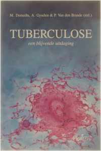 Tuberculose - een blijvende uitdaging