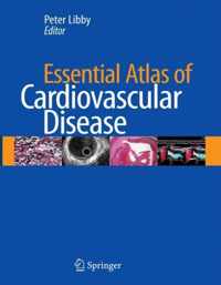 Essential Atlas of Cardiovascular Disease