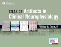 Artifacts in Clinical Neurophysiology