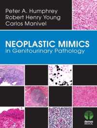 Neoplastic Mimics in Genitourinary Pathology