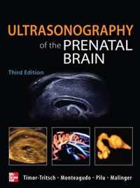 Ultrasonography of the Prenatal Brain