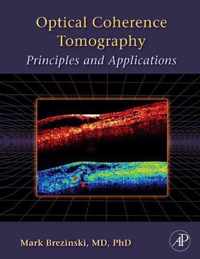 Optical Coherence Tomography