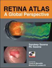 Retina Atlas