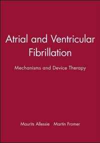 Atrial and Ventricular Fibrillation