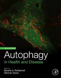 Autophagy in Health and Disease