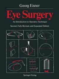 Eye Surgery
