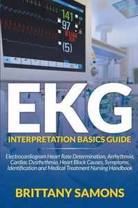 EKG Interpretation Basics Guide