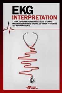 EKG Interpretation