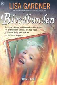 Bloedbanden