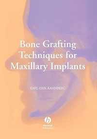 Bone Grafting Techniques for Maxillary Implants
