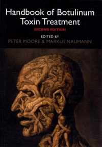 Handbook of Botulinum Toxin Treatment