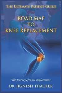 Road Map to Knee Replacement