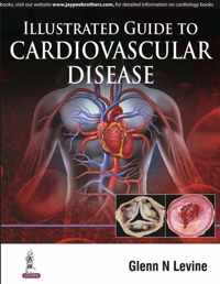 Illustrated Guide to Cardiovascular Disease