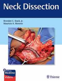 Neck Dissection