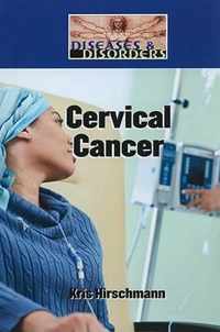 Cervical Cancer