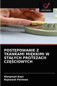 Postpowanie Z Tkankami Mikkimi W Stalych Protezach Czciowych