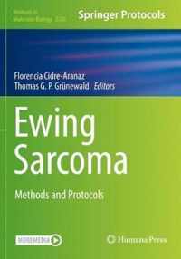 Ewing Sarcoma