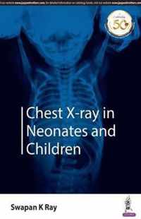 Chest X-ray in Neonates and Children