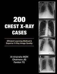 200 Chest X-Ray Cases