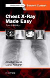 Chest X-Ray Made Easy