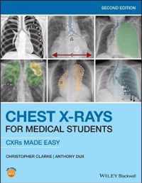 Chest X-Rays for Medical Students 2nd Ed