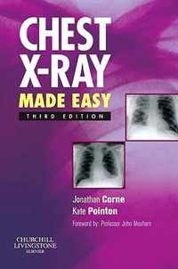 Chest X-Ray Made Easy