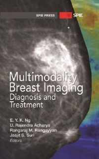 Multimodality Breast Imaging