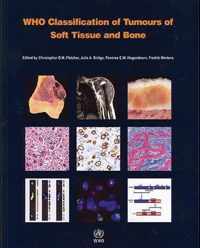 WHO classification of tumours of soft tissue and bone