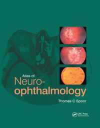 Atlas of Neuro-ophthalmology