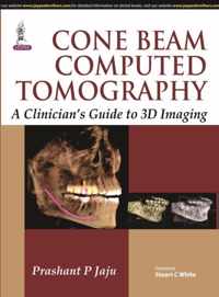 Cone Beam Computed Tomography
