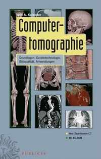 Computertomographie