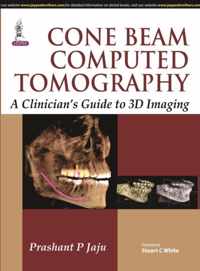 Cone Beam Computed Tomography