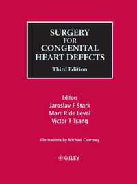 Surgery For Congenital Heart Defects