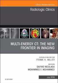 Multi-Energy CT: The New Frontier in Imaging, An Issue of Radiologic Clinics of North America