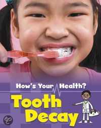 Tooth Decay