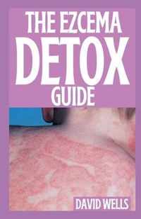 The Ezcema Detox Guide