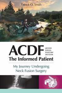 Acdf: The Informed Patient
