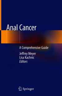 Anal Cancer