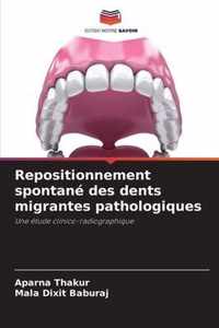 Repositionnement spontane des dents migrantes pathologiques
